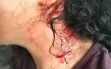 اعتداء جماعي عنيف على فتاة (16 عامًا) داخل حافلة في...