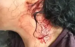 اعتداء جماعي عنيف على فتاة (16 عامًا) داخل حافلة في بيت شيمش