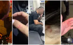 7 مصابين بمواجهات بين الشرطة والحريدييم قرب بني براك