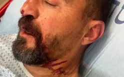 بسبب رفضه إنزاله في مكان ممنوع.. اعتقال فتى ضرب سائق حافلة بـ