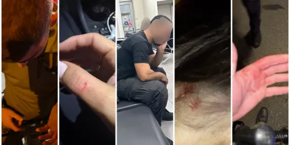 7 مصابين بمواجهات بين الشرطة والحريدييم قرب بني براك