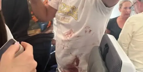 بالفيديو - هذان هما الطيار ومساعد الطيار العماني المصابان بجروح بالغة جراء محاولة...