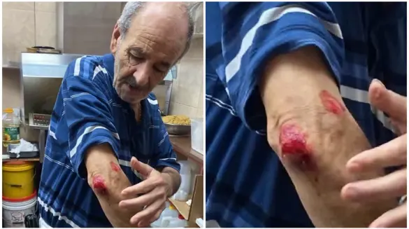حيفا: اعتداء عنصري وترديد شعارات نابية بحق مسن عربي